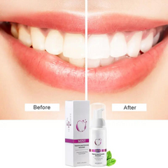 Tooth Whitening Mousse