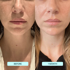 Facial Collagen Films