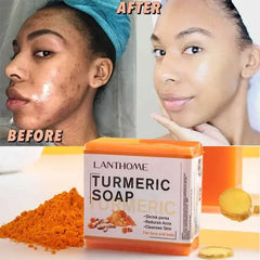 Turmeric Soap Face Cleansing Anti Acne Remove Pimples Dark Spots