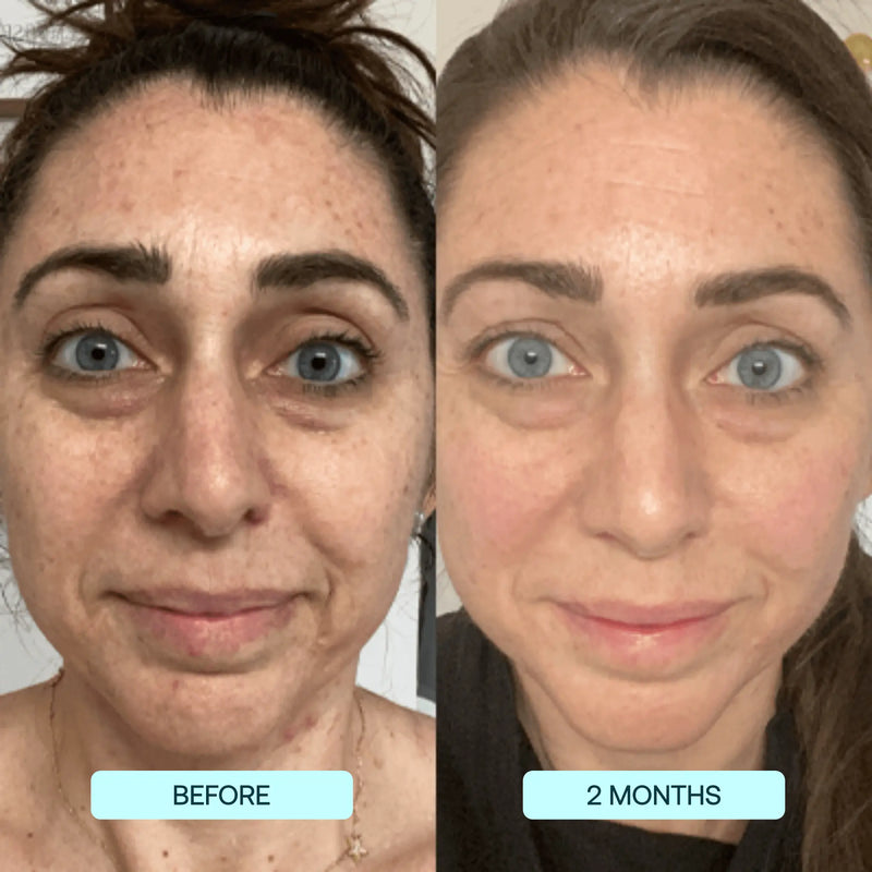 Facial Collagen Films